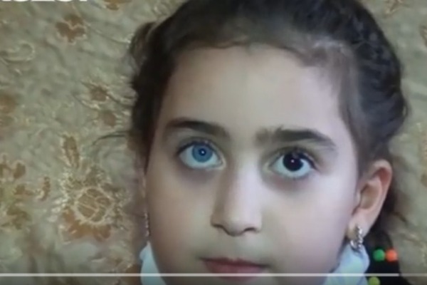 6 yaşlı Zəhranın gözlərinin biri göy, digəri isə qaradır (VİDEO)