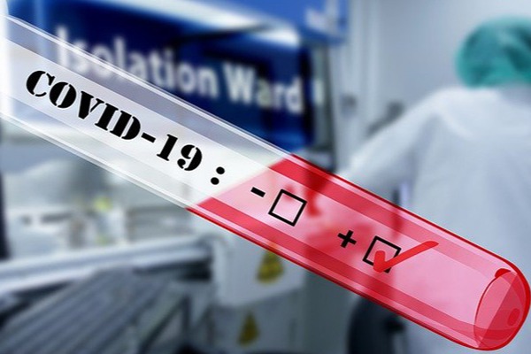 Azərbaycanda daha 44 nəfərdə koronavirus aşkarlandı -      1 nəfər vəfat etdi, 74 nəfər sağaldı