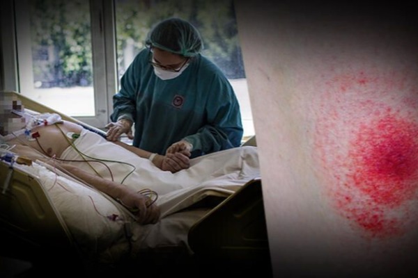 Azərbaycanın qonşuluğunda yeni dəhşətli virus yayılır –        KORONAVİRUSU UNUDUN!