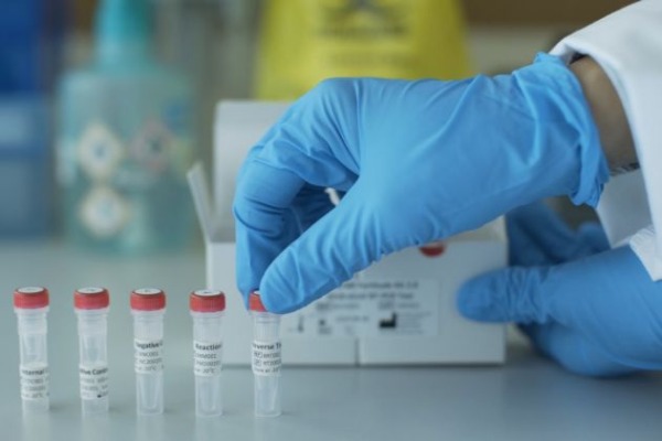 Azərbaycanda koronavirusa daha 588 yoluxma qeydə alınıb, 7 nəfər vəfat edib