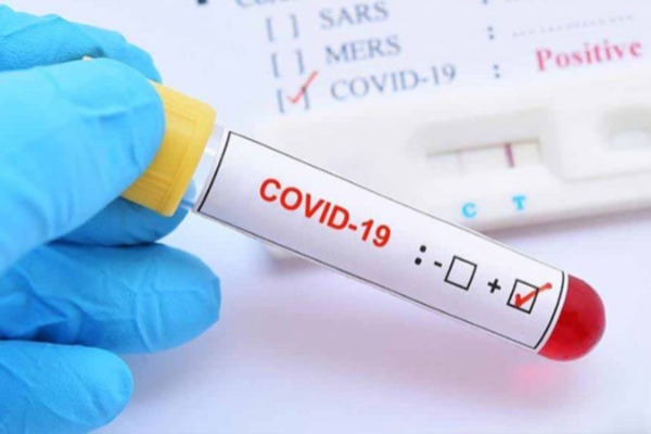 COVID-19