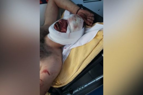 Зверства армян против азербайджанцев в Бельгии