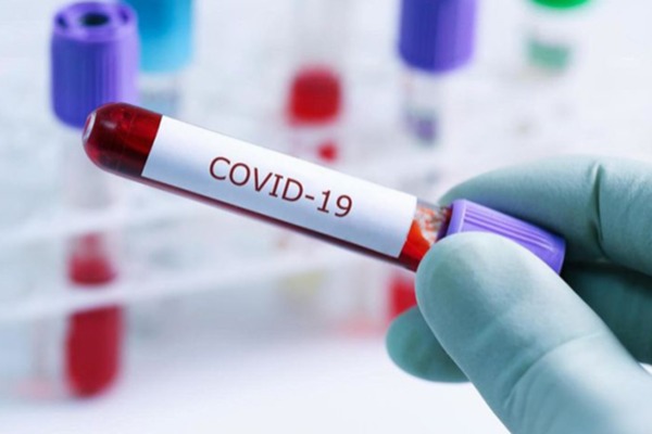Koronavirus infeksiyasına yoluxanların sayı ilə bağlı statistika açıqlanıb