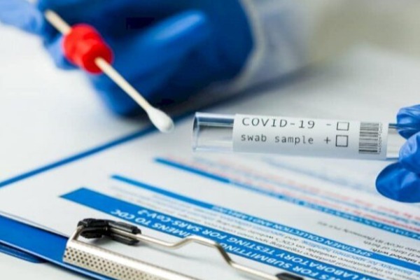 Virus dünyanı cənginə alıb: Yoluxanların sayı 154 milyonu ötdü