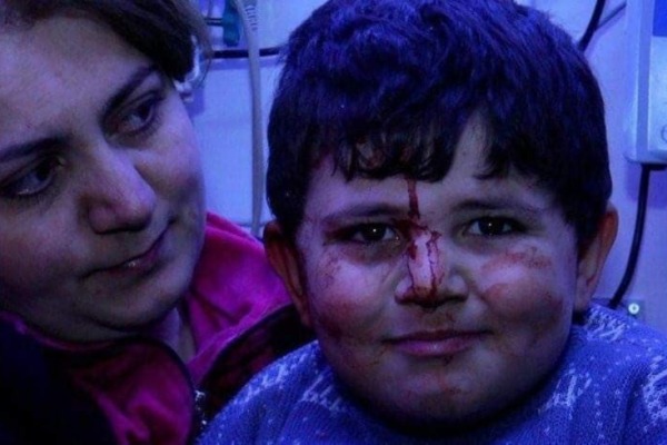 Erməni terrorunun canlı şahidi 6 yaşlı Bəxtiyar: Evimizə bomba düşəndə qorxmadım, heç kişi də qorxar?